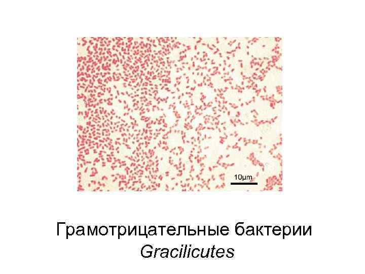 Грамотрицательные бактерии Gracilicutes 