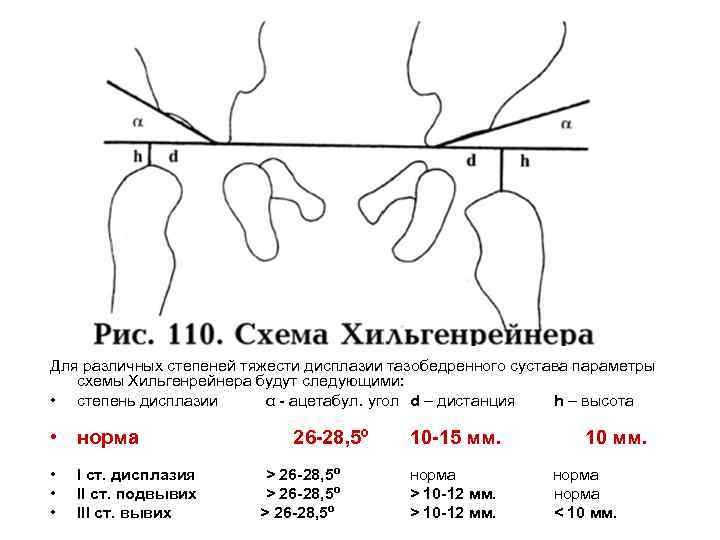 Для различных степеней тяжести дисплазии тазобедренного сустава параметры схемы Хильгенрейнера будут следующими: • степень