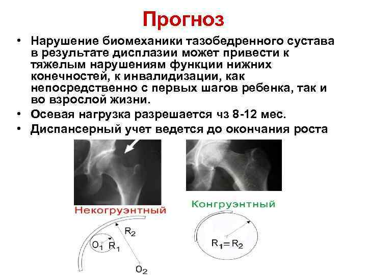 Признаки дисплазии