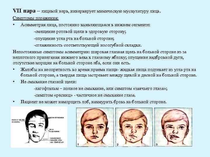 Симптомы поражения лицевого