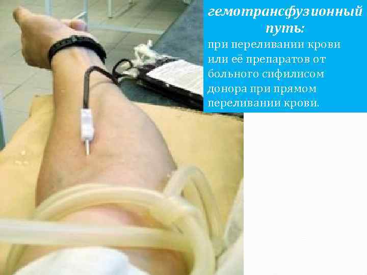гемотрансфузионный путь: при переливании крови или её препаратов от больного сифилисом донора при прямом