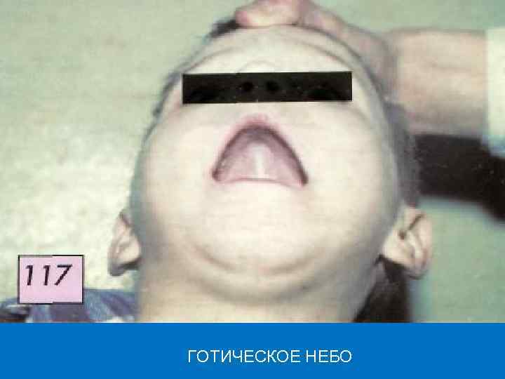 ГОТИЧЕСКОЕ НЕБО 