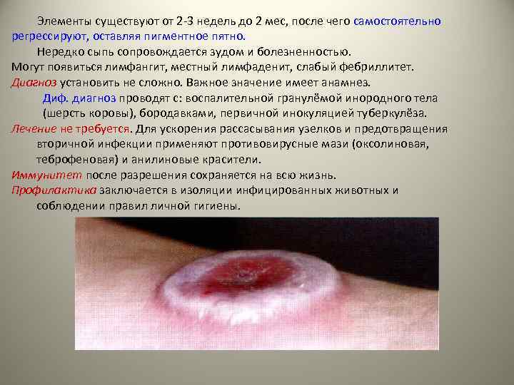 Элементы существуют от 2 -3 недель до 2 мес, после чего самостоятельно регрессируют, оставляя