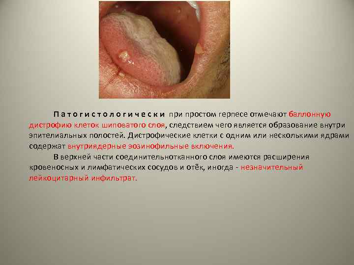  П а т о г и с т о л о г и