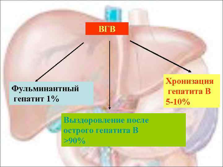 ВГВ Фульминантный гепатит 1% Выздоровление после острого гепатита В >90% Хронизация гепатита В 5