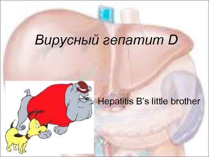 Вирусный гепатит D Hepatitis B’s little brother 