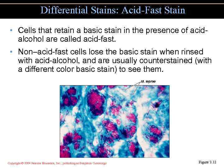 Differential Stains: Acid-Fast Stain • Cells that retain a basic stain in the presence