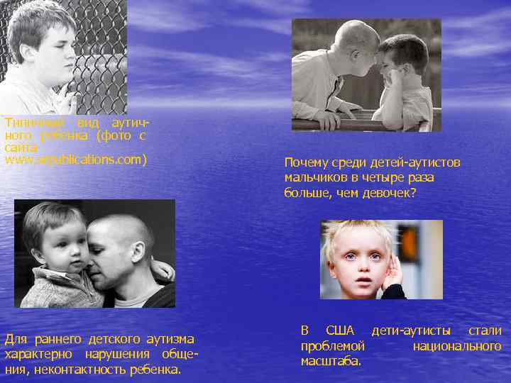 Типичный вид аутичного ребенка (фото с сайта www. srpublications. com) Для раннего детского аутизма