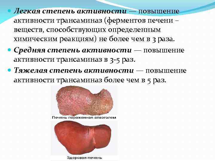  Легкая степень активности — повышение активности трансаминаз (ферментов печени – веществ, способствующих определенным