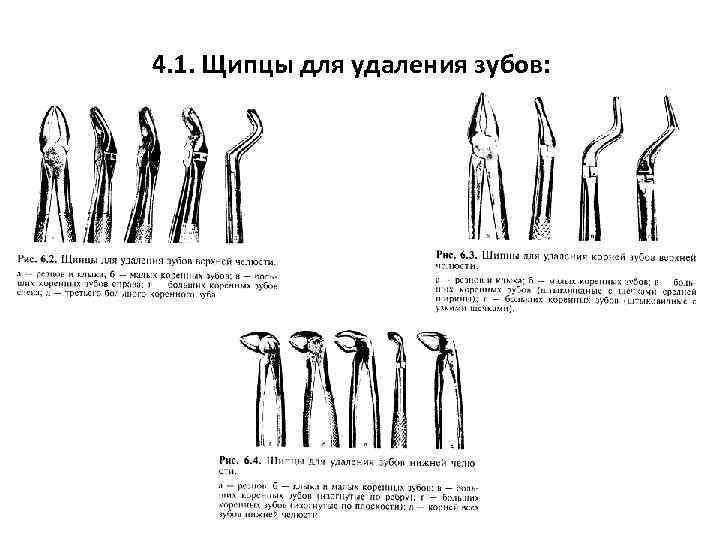 Щипцы для удаления зубов нижней челюсти с названиями и фото