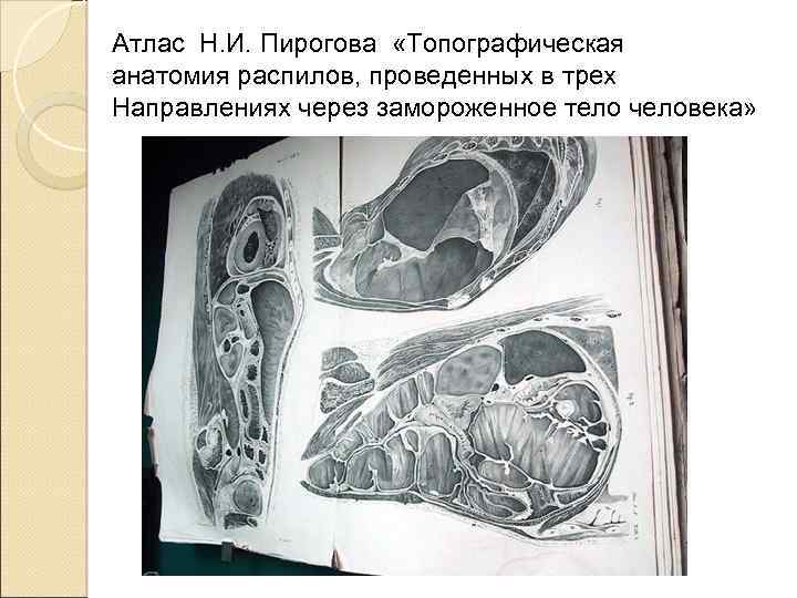 Пирогов николай иванович топографическая анатомия