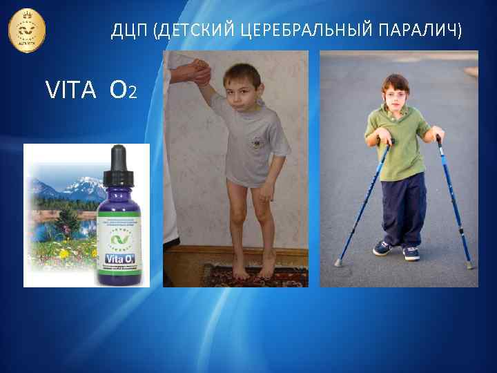 ДЦП (ДЕТСКИЙ ЦЕРЕБРАЛЬНЫЙ ПАРАЛИЧ) VITA O 2 