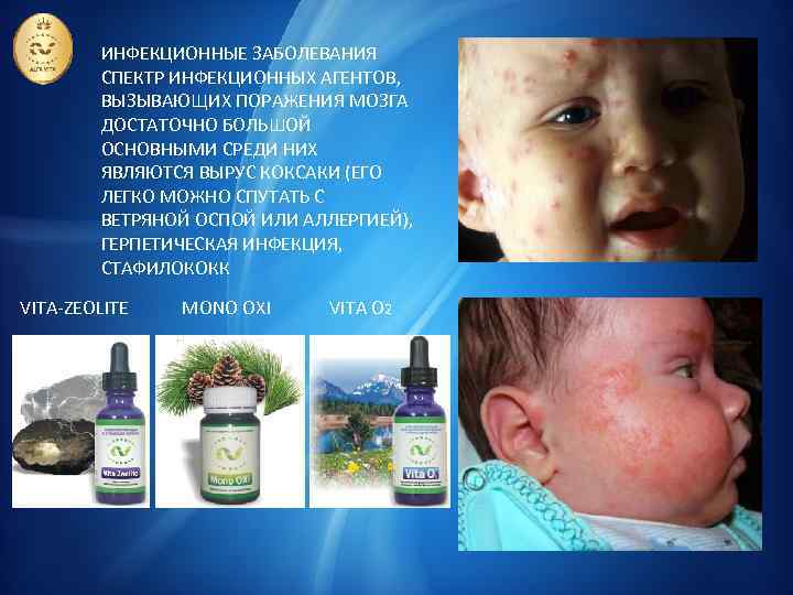 ИНФЕКЦИОННЫЕ ЗАБОЛЕВАНИЯ СПЕКТР ИНФЕКЦИОННЫХ АГЕНТОВ, ВЫЗЫВАЮЩИХ ПОРАЖЕНИЯ МОЗГА ДОСТАТОЧНО БОЛЬШОЙ ОСНОВНЫМИ СРЕДИ НИХ ЯВЛЯЮТСЯ