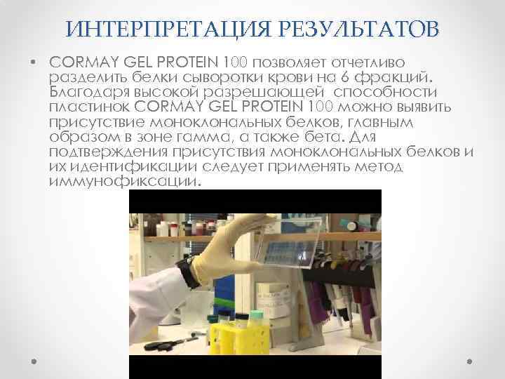 ИНТЕРПРЕТАЦИЯ РЕЗУЛЬТАТОВ • CORMAY GEL PROTEIN 100 позволяет отчетливо разделить белки сыворотки крови на