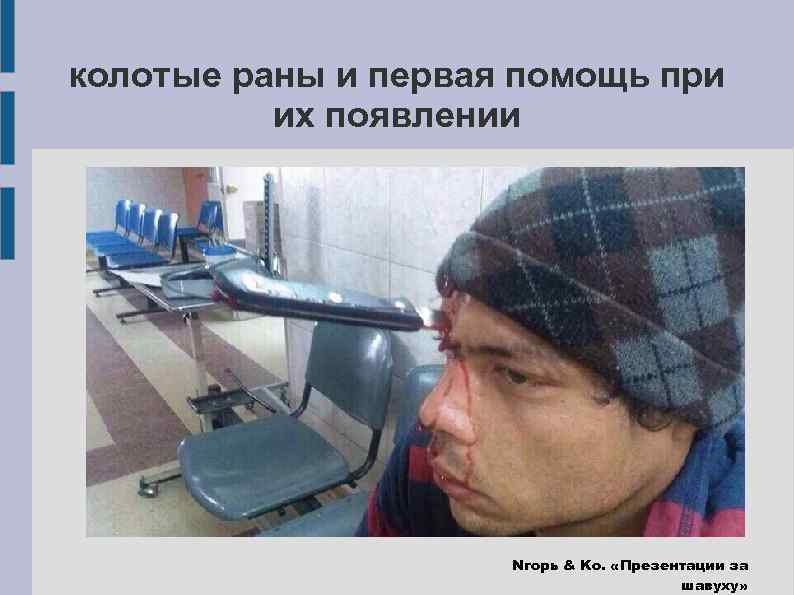 колотые раны и первая помощь при их появлении Nгорь & Ko. «Презентации за шавуху»