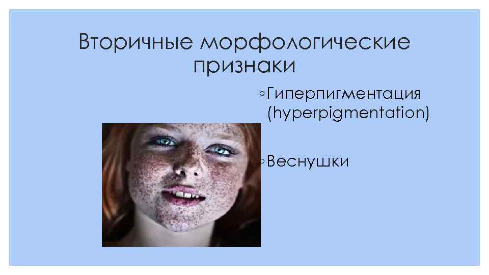 Вторичные морфологические признаки ◦ Гиперпигментация (hyperpigmentation) ◦ Веснушки 