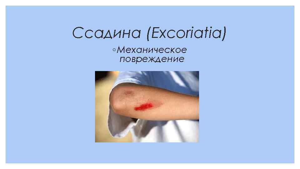 Ссадина (Excoriatia) ◦ Механическое повреждение 