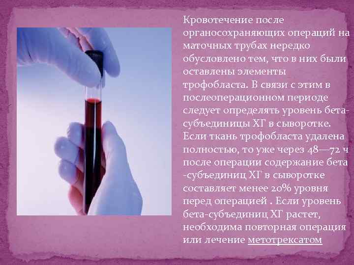 Кровотечение после органосохраняющих операций на маточных трубах нередко обусловлено тем, что в них были