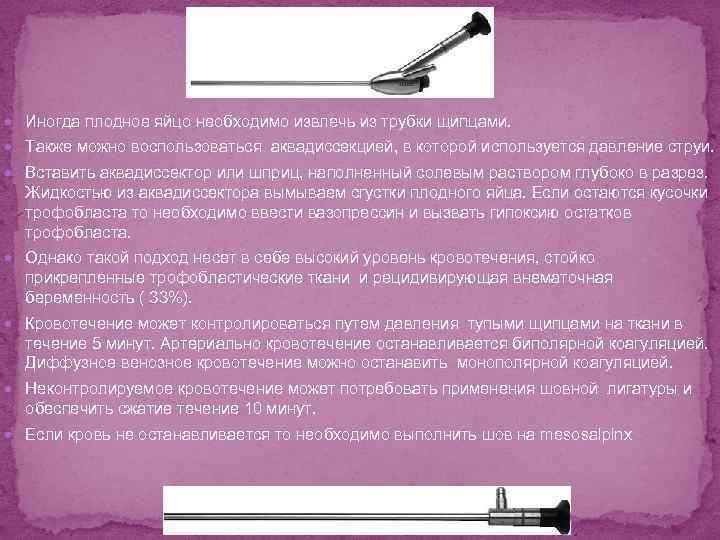  Иногда плодное яйцо необходимо извлечь из трубки щипцами. Также можно воспользоваться аквадиссекцией, в