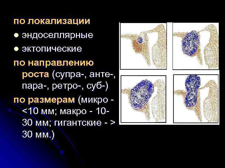 по локализации l эндоселлярные l эктопические по направлению роста (супра-, анте-, пара-, ретро-, суб-)