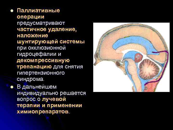 l l Паллиативные операции предусматривают частичное удаление, наложение шунтирующей системы при окклюзионной гидроцефалии и