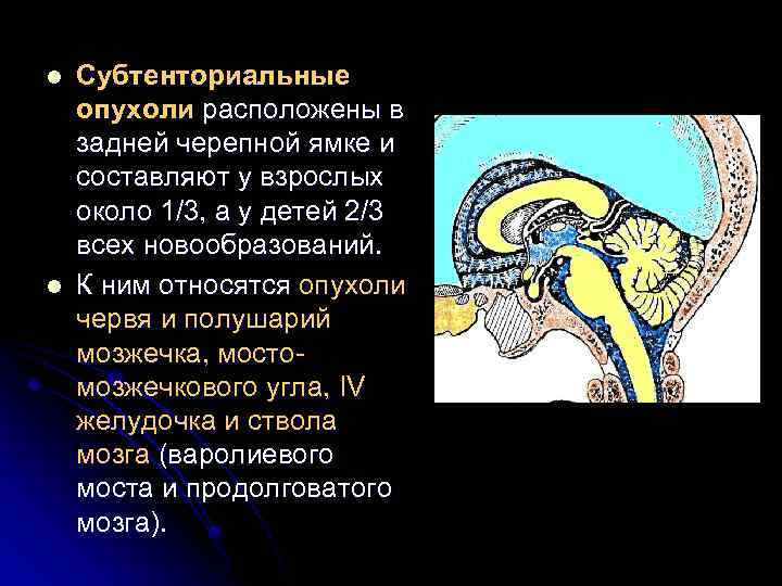 l l Субтенториальные опухоли расположены в задней черепной ямке и составляют у взрослых около