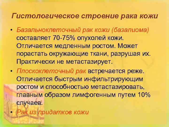 Гистологическое строение рака кожи • Базальноклеточный рак кожи (базалиома) составляет 70 -75% опухолей кожи.