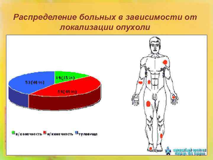 Распределение больных в зависимости от локализации опухоли 