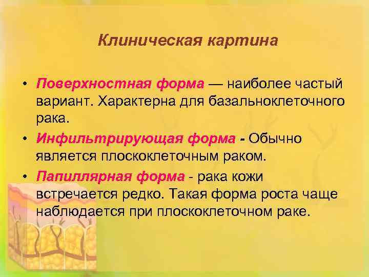 Клиническая картина • Поверхностная форма — наиболее частый вариант. Характерна для базальноклеточного рака. •