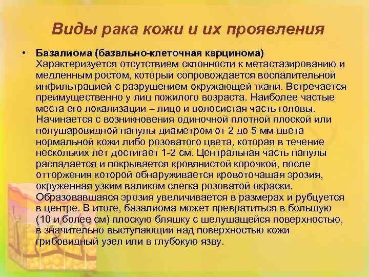 Виды рака кожи и их проявления • Базалиома (базально-клеточная карцинома) Характеризуется отсутствием склонности к