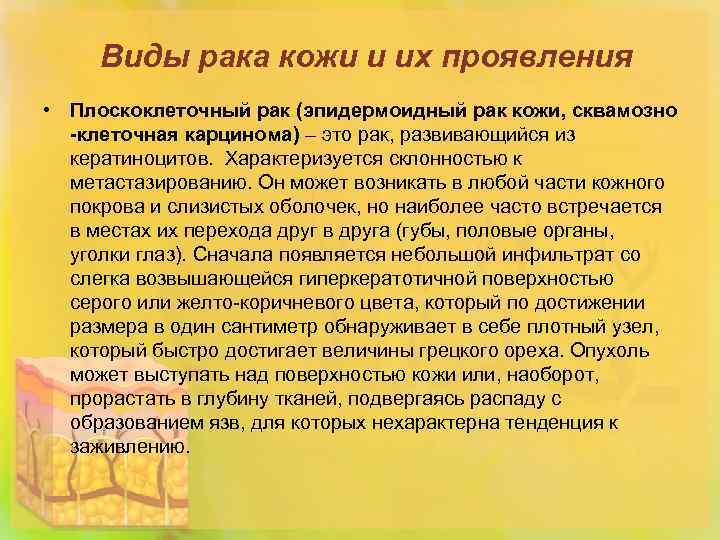 Виды рака кожи и их проявления • Плоскоклеточный рак (эпидермоидный рак кожи, сквамозно -клеточная