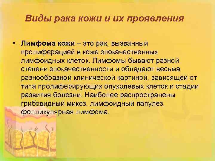 Виды рака кожи и их проявления • Лимфома кожи – это рак, вызванный пролиферацией