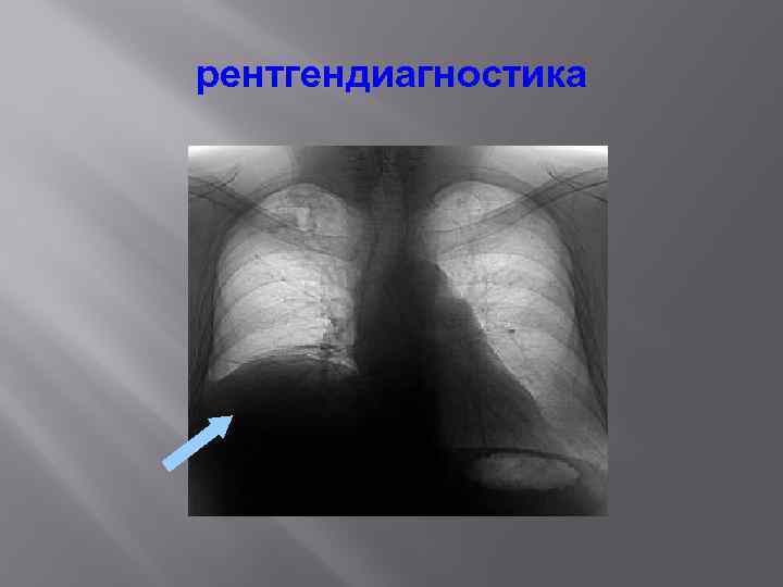 рентгендиагностика 