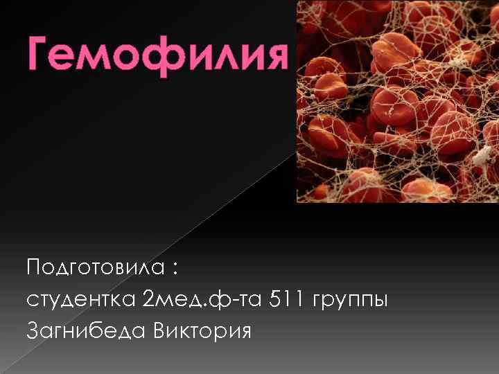 Гемофилия Подготовила : студентка 2 мед. ф-та 511 группы Загнибеда Виктория 