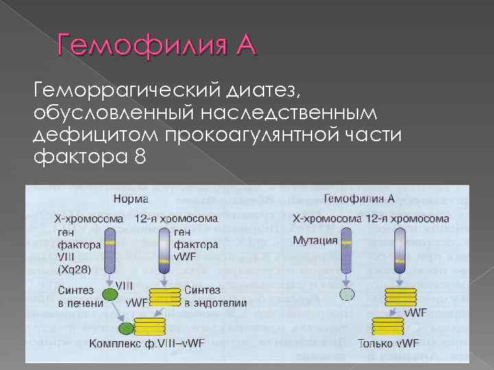 Гемофилия А Геморрагический диатез, обусловленный наследственным дефицитом прокоагулянтной части фактора 8 