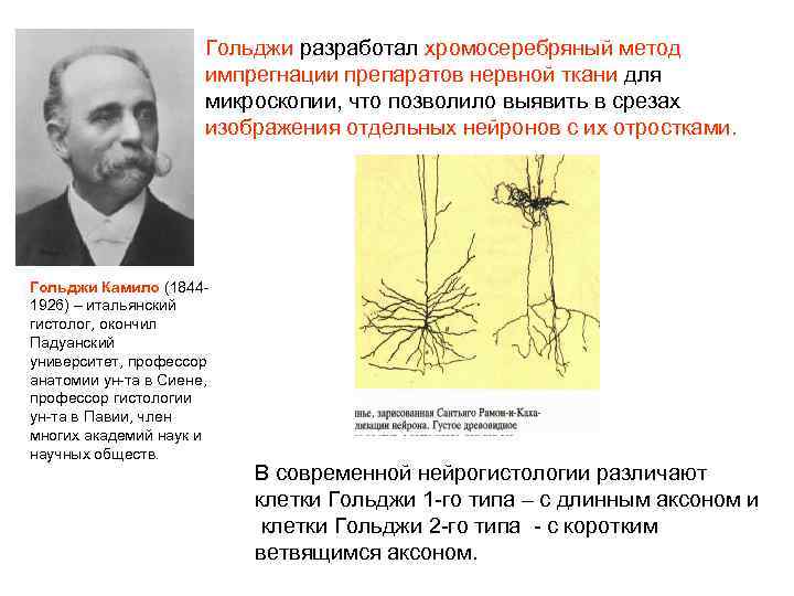 Клетки беца. Метод Гольджи. Окраска нейронов по Гольджи. Метод Гольджи нервная ткань. Нейроны Гольджи 1 типа.