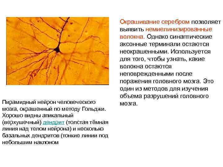 Пирамидный нейрон человеческого мозга, окрашенный по методу Гольджи. Хорошо видны апикальный (верхушечный) дендрит (толстая