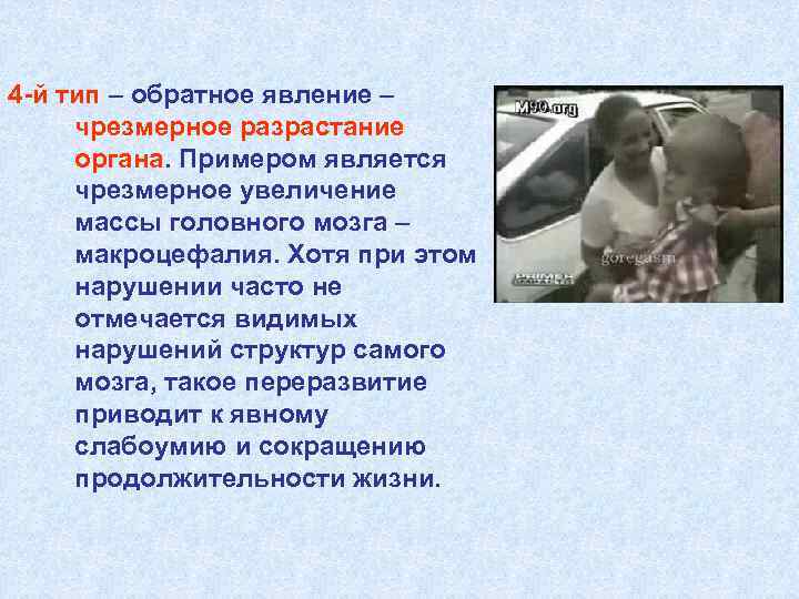 4 -й тип – обратное явление – чрезмерное разрастание органа. Примером является чрезмерное увеличение