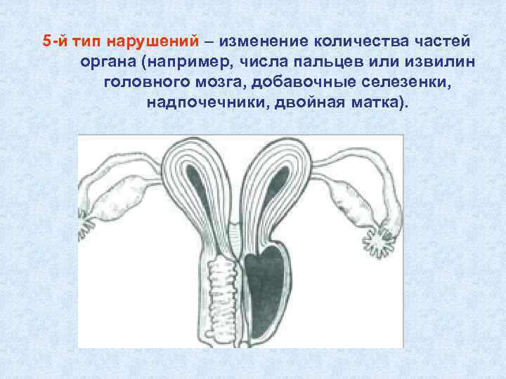 5 -й тип нарушений – изменение количества частей органа (например, числа пальцев или извилин