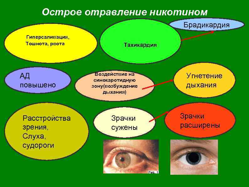 Острое отравление никотином Брадикардия Гиперсаливация, Тошнота, рвота АД повышено Расстройства зрения, Слуха, судороги Тахикардия