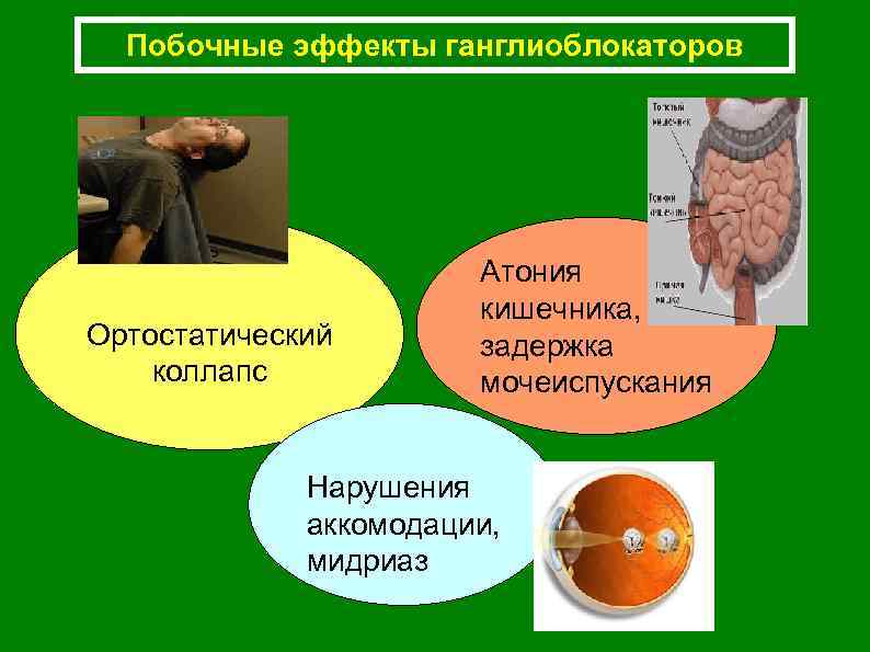 Побочные эффекты ганглиоблокаторов Ортостатический коллапс Атония кишечника, задержка мочеиспускания Нарушения аккомодации, мидриаз 