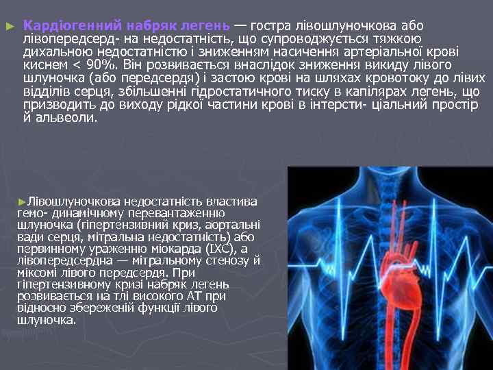 ► Кардіогенний набряк легень — гостра лівошлуночкова або лівопередсерд на недостатність, що супроводжується тяжкою