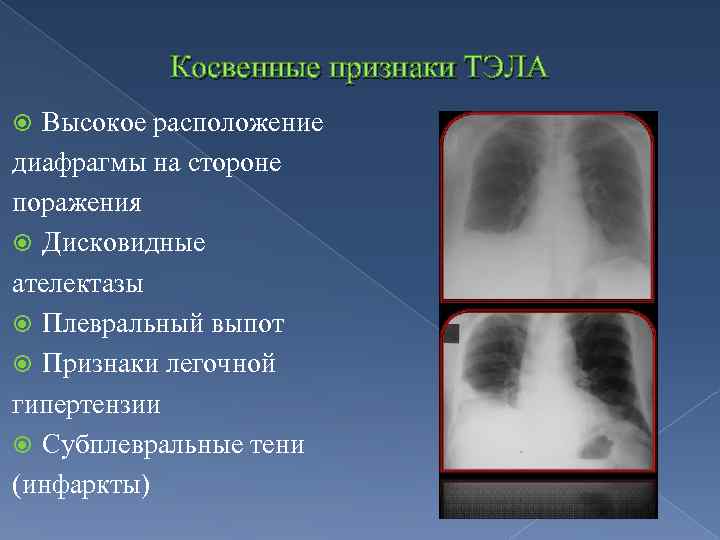 Рентген картина тэла