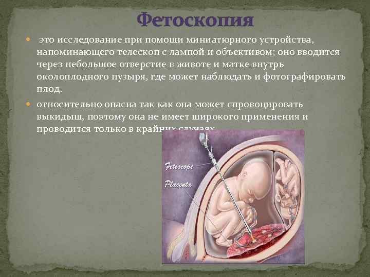 Фетоскопия это исследование при помощи миниатюрного устройства, напоминающего телескоп с лампой и объективом; оно
