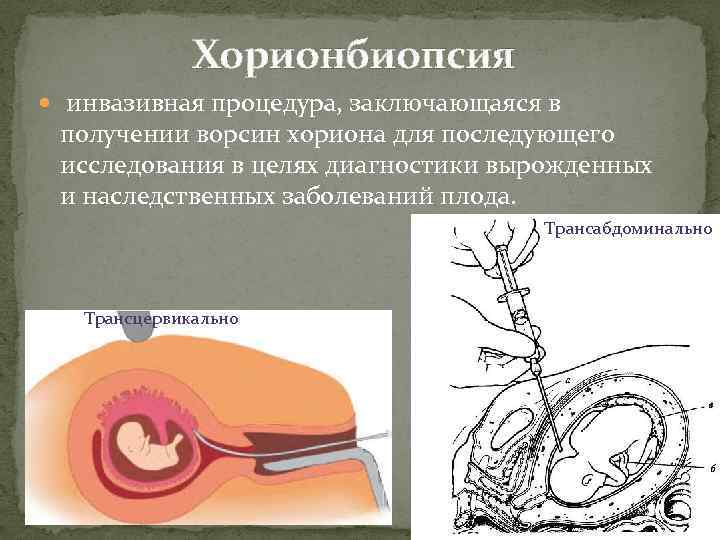 Хорионбиопсия инвазивная процедура, заключающаяся в получении ворсин хориона для последующего исследования в целях диагностики