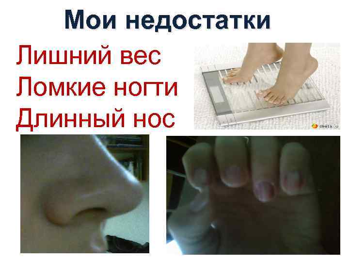 Мои недостатки Лишний вес Ломкие ногти Длинный нос 