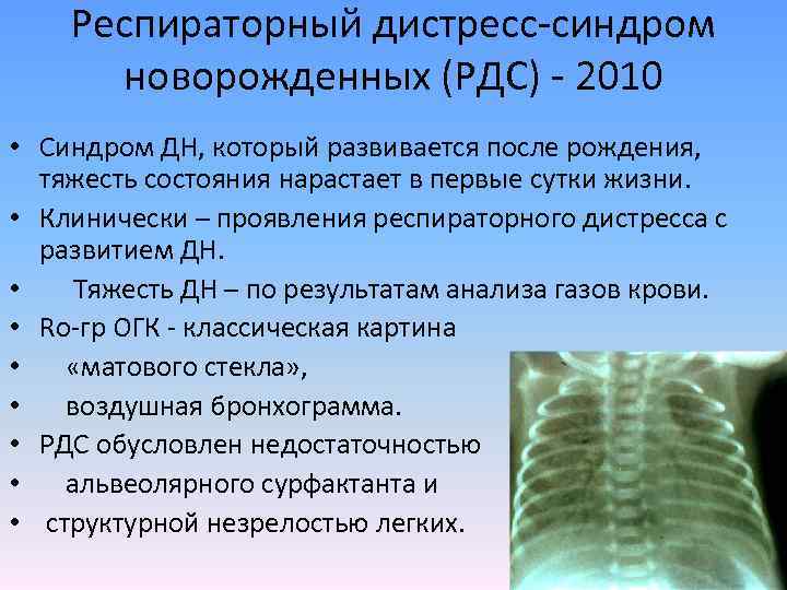 Респираторный дистресс-синдром новорожденных (РДС) - 2010 • Синдром ДН, который развивается после рождения, тяжесть