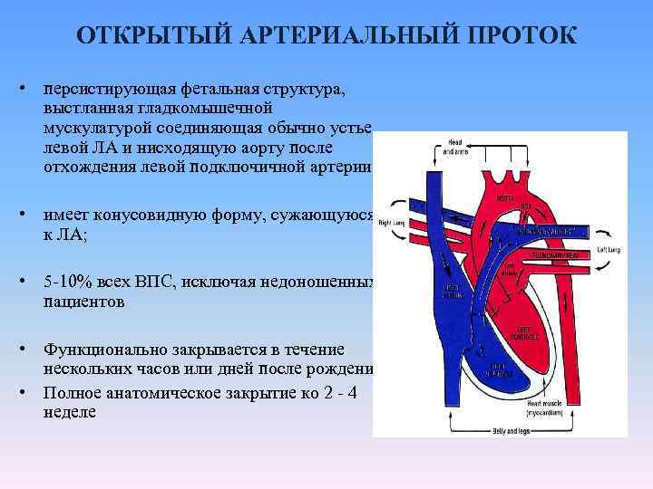 ОТКРЫТЫЙ АРТЕРИАЛЬНЫЙ ПРОТОК • персистирующая фетальная структура, выстланная гладкомышечной мускулатурой соединяющая обычно устье левой