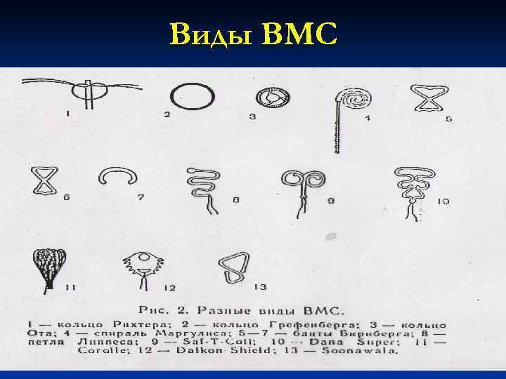 Внутриматочная спираль схема