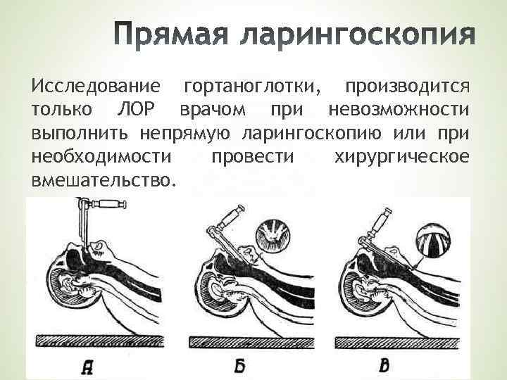 Исследование гортаноглотки, производится только ЛОР врачом при невозможности выполнить непрямую ларингоскопию или при необходимости